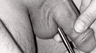 Catheters